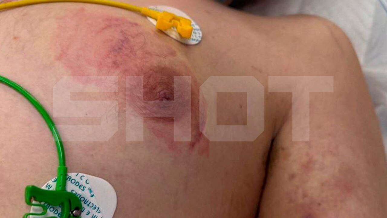 Комната пыток для детей обнаружена в подмосковном рехабе 24 подростка насильно удерживали и избивали в р...