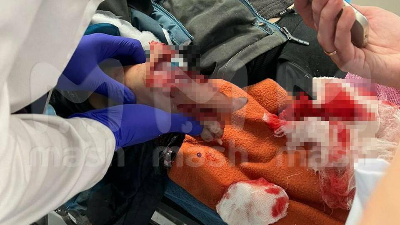 В Красногорске 9-летний ребёнок вечером наканун...