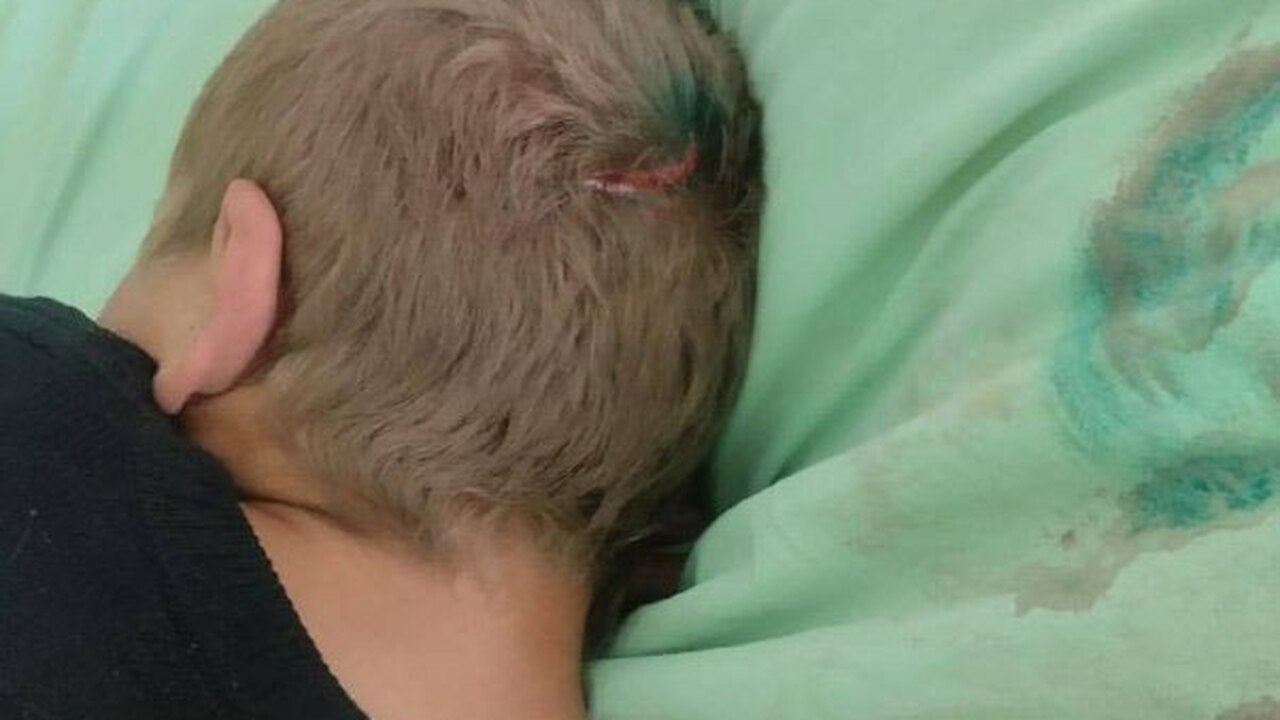 В Сети распространилось видео с пациентом из ин...